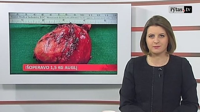 Studentei išoperavo 1,5 kg auglį (II)