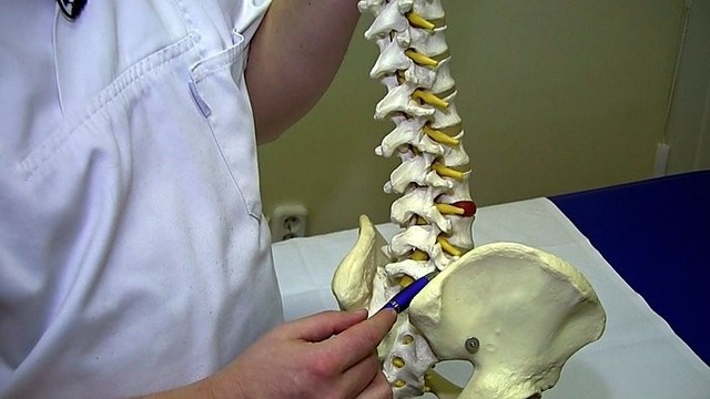 Kaip atsikratyti nugaros skausmų?