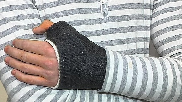 Unikali operacija Santariškėse vilniečiui grąžino ranką