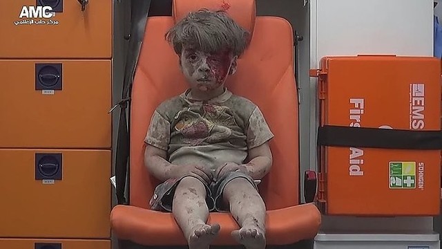Antskrydį išgyvenęs berniukas tapo Sirijos karo simboliu