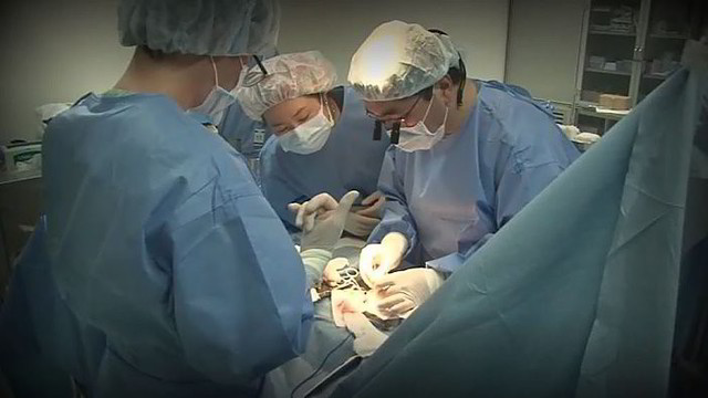 Pietų Korėjos medikai džiūgauja – beždžionei persodino kiaulės širdį