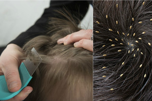 Kai niekas nedraudžia, po atostogų vaikai į mokyklas vis dar grįžta utelėti