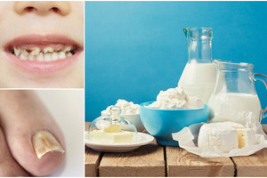 Trys neeiliniai požymiai, rodantys, kad jums trūksta svarbios medžiagos