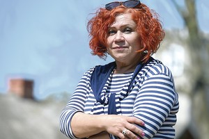 Humoristės veide – dideli pokyčiai: ryžosi netikėtoms procedūroms