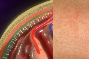 Svarbu laiku pastebėti šiuos apgaulingus požymius, tik tada išgelbėsite gyvybę