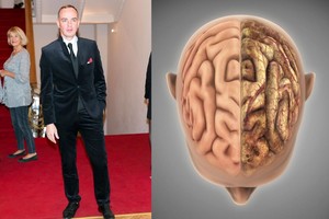 Dizainerį užklupusi pražūtinga liga gali pasivyti visur – simptomai lieka nepastebėti