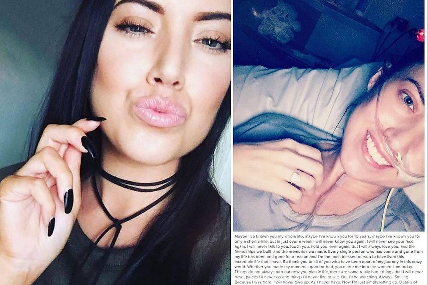 25-erių australė Nardya Miller prieš savaitę išgirdo iš medikų negailestingą verdiktą. Jos organizmas atmetė donoro plaučius.<br>Socialinių tinklų nuotr.
