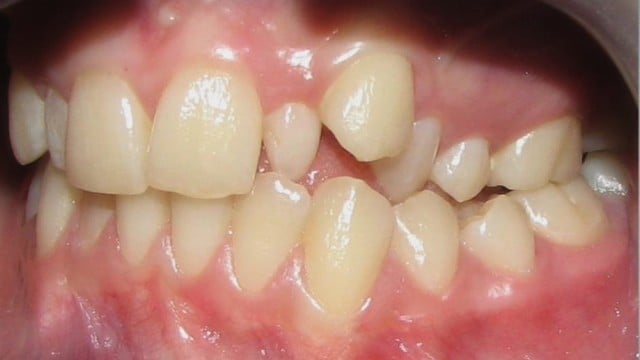 Ortodontinis gydymas – ko dar nežinojote 