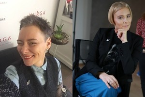 Jurga Lago ryžosi pokyčiams: „Nebus kovos už amžiną jaunystę“