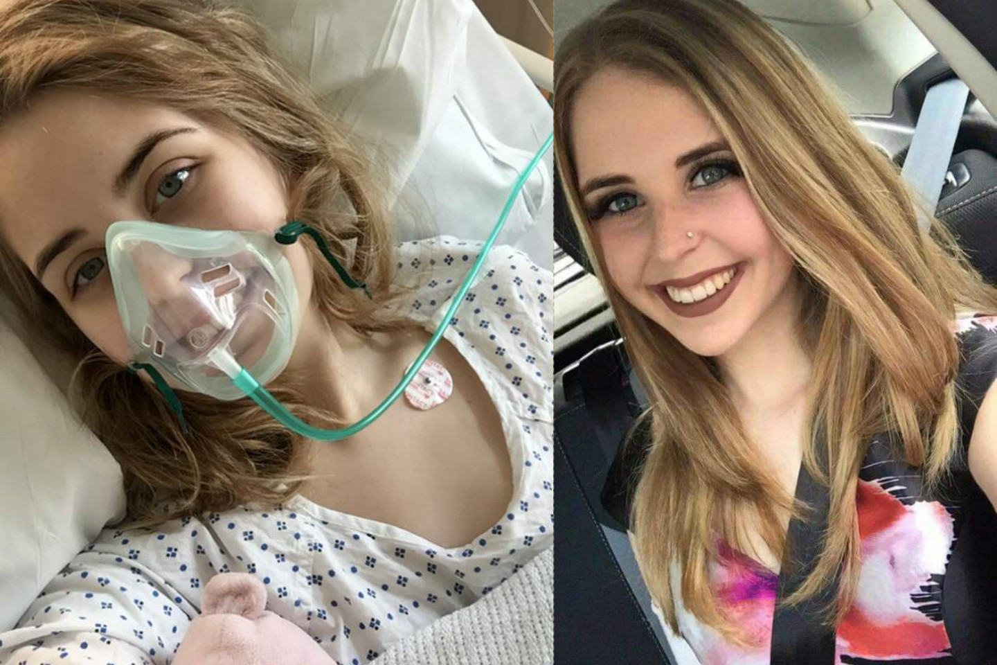 Nepaisant operacijos bei taikyto gydymo, šį savaitgalį Hannah gyvybė užgeso.<br>Socialinių tinklų nuotr.