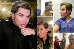 Žmogus-lėlė Kenas toliau šėlsta: pasidarė jau 50-tą operaciją