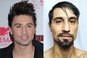 Rusų dievaitis Dima Bilanas pasikeitė neatpažįstamai