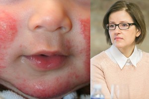 Brangiausio žmogaus liga varė į kampą, bet rado išeitį, kuri nieko nekainavo