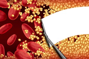 Paprastas receptas, padėsiantis sumažinti cholesterolį