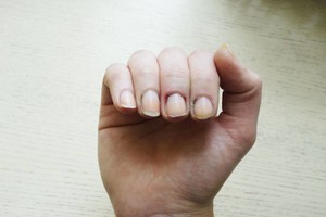 Jei norite išvengti tokių nemalonumų, perskaitykite šiuos patarimus