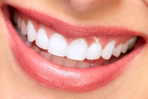 Balta šypsena nekainuos nė euro: prireiks tik vienos priemonės