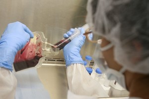 Iš kur atsirado ir kaip paplito AIDS?