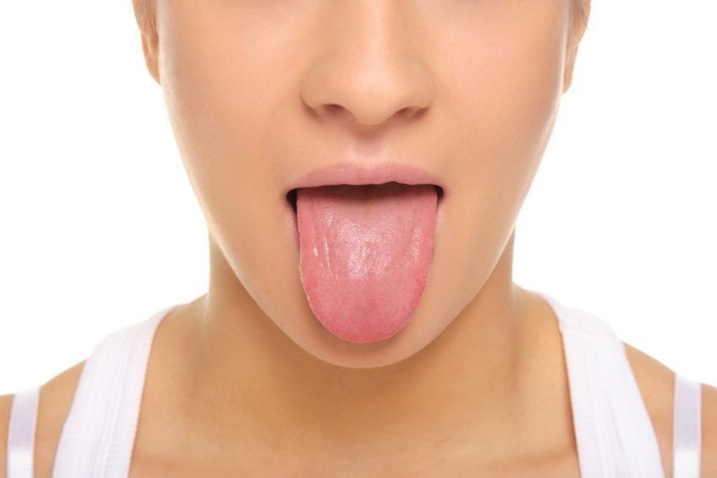 Sveiko žmogaus liežuvis yra rožinės spalvos, drėgnas, jį dengia skaidrios apnašos.<br>123rf