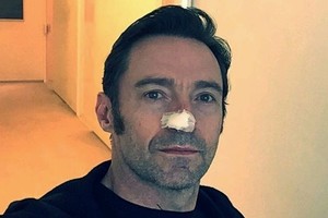 Aktoriui Hugh Jackmanui šeštą kartą operuotas vėžys