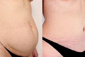 Trijų vaikų mama pasiryžo permainoms: „Tai buvo geriausias mano sprendimas“