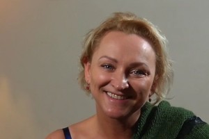 Sulieknėjusi Inga Norkutė-Žvinienė išvaizdą dar padailino botulino injekcijomis