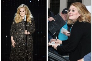 Balsingoji Adele nustebino kardinaliais išvaizdos pokyčiais