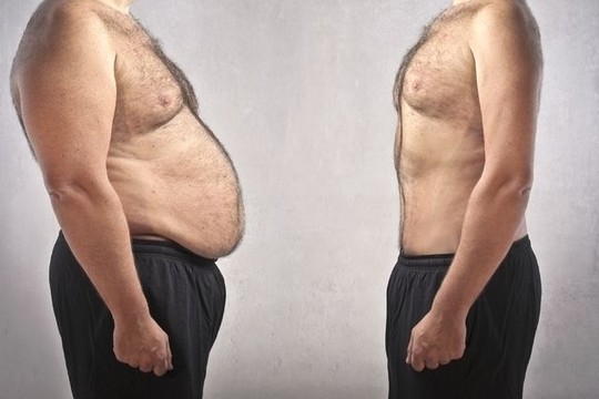 Šias klaidas daro daugelis ir jos jums trukdo sulieknėti