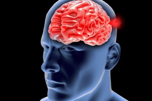 Yra baisesnė diagnozė nei vėžys – liga be simptomų baigiasi staigia mirtimi