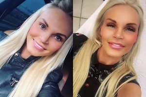 Vita Pliadytė sukėlė kalbų pliūpsnį: moteris susimažino lūpas?