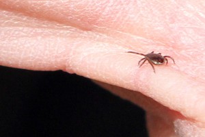 Aptikote ant savo kūno tai? Padaromos 2 klaidos, kurios turi baisių pasekmių