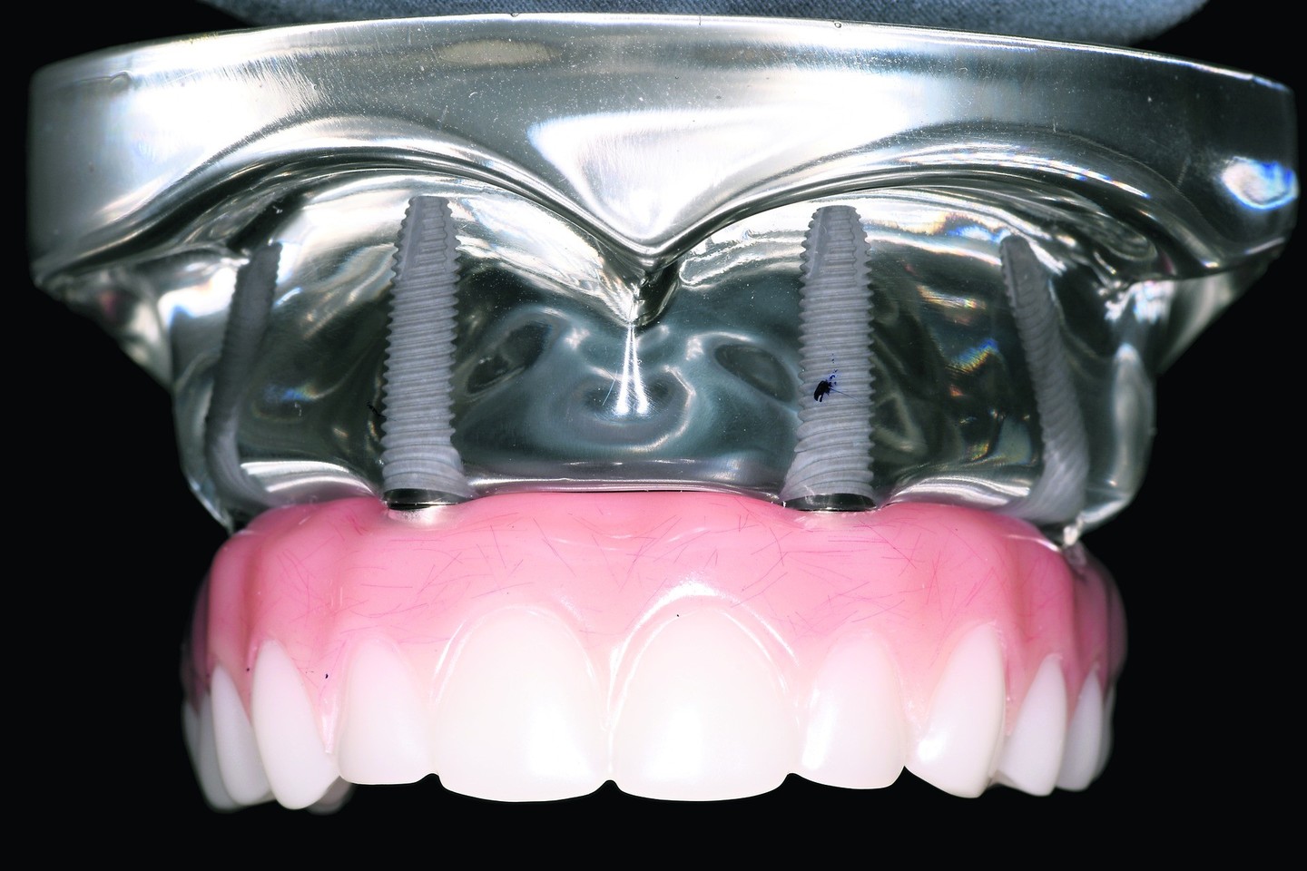 Per seminarus naudojami parodomieji modeliai aiškiai parodo, kaip atrodo ant 4 implantų atkurti vieno žandikaulio dantys.
