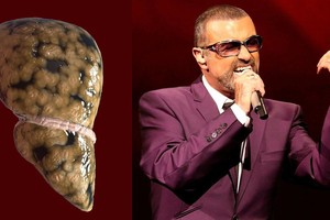 Garsaus atlikėjo mirties priežastis primena, kad auka gali tapti kiekvienas