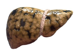 Šiurpi statistika: nieko neskauda, bet kepenys beveik prarastos