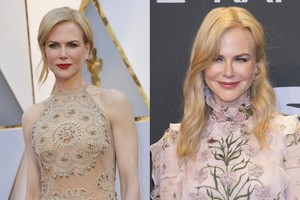 Pakitusi Nicole Kidman veido forma pakurstė kalbas