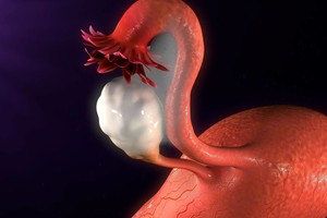 Ligą, kuri tampa nuosprendžiu, būtina pastebėti laiku