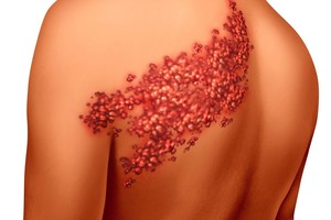 Būtina žinoti: 6 požymiai, kad negalite valgyti daugelio pamėgtų produktų