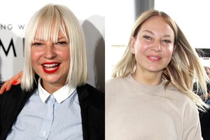 Ilgą laiką žaidusi slėpynes dainininkė Sia parodė „keistų operacijų“ rezultatą