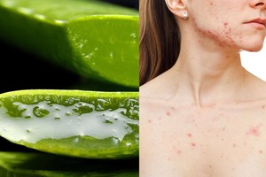 Aknė, aukštas kraujospūdis ir kitos rimtos ligos liks užmarštyje – prireiks tik vieno dalyko