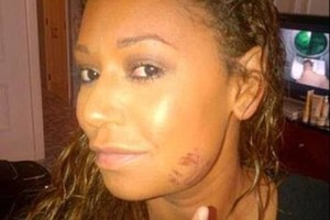 Mel B išpažintis: vyras ją mušė, vertė mylėtis trise ir su aukle laukėsi kūdikio