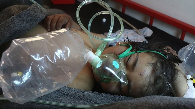 Trumpos žinios: Sirijoje įvykdyta cheminė ataka sulaukė didžiulio vakarų pasipiktinimo