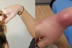 Jei darote tai – privalote tuoj pat liautis