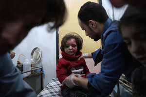 Cheminės atakos siaubai: vaikai apsinuodijo ieškodami tėvų, kūnai gulėjo krūvomis