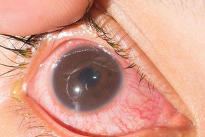 Kartu su pavasariu atkeliauja ir nemalonumai – štai kas jums gresia