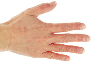 Pasitikrinkite: keli požymiai byloja, kad jūsų organizmui trūksta mirtinai svarbaus dalyko