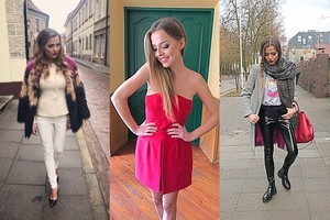 Vaida Skaisgirė atskleidė opiausią savo išvaizdos bėdą