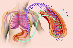Kasdien visų vartojamas produktas nulemia rimtas ligas ir net vėžį