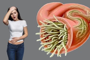 Šunų ir kačių platinama liga - štai kaip jos galite išvengti