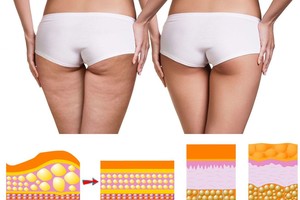 Vos 90 sekundžių kas rytą ir jūsų gyvenimas bei išvaizda pasikeis neatpažįstamai