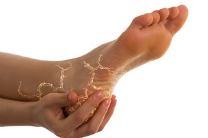 Kojų mėšlungis ir kiti požymiai byloja apie tai, ko stinga organizmui