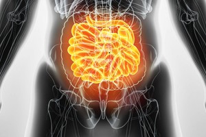 Šokiruojantis atradimas: tam tikro maisto netoleravimą gali sukelti paprastas virusas